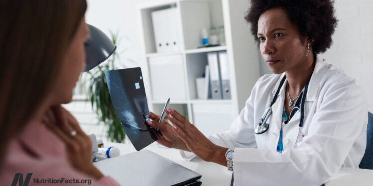 Can Oxidized Cholesterol 27HC Explain Three Breast Cancer Mysteries?