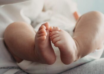 Can Reflux in Babies Be Treated with Diet? 