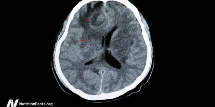 Toxoplasmosis and Schizophrenia 