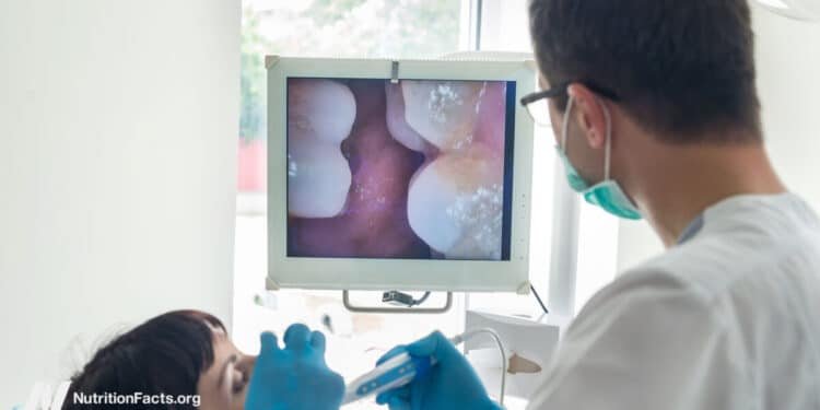Can We Stop Tooth Decay? 