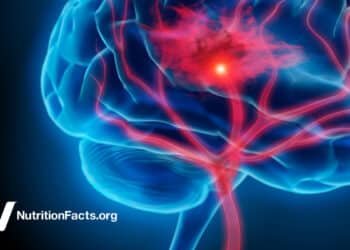 Eating for Stroke Prevention