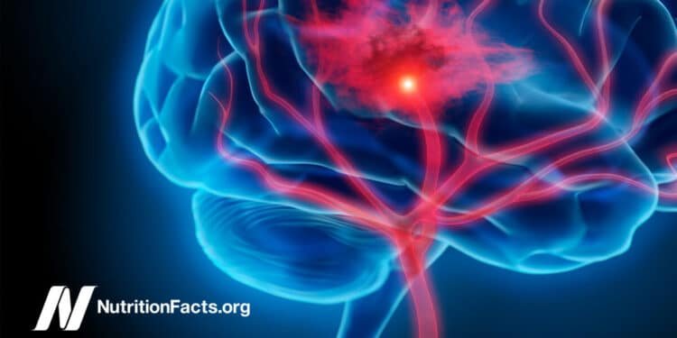 Eating for Stroke Prevention