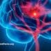 Eating for Stroke Prevention