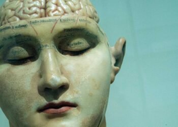 Calcification of the Pineal Gland Shows a Strong Correlation in the Developing of Alzheimer’s Disease