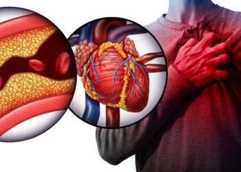 The American Heart Association States More Than 40% Of Adults Have Clogged Arteries Unknowingly, Clean Them Out With These 3 Simple Fruits
