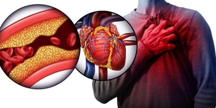 The American Heart Association States More Than 40% Of Adults Have Clogged Arteries Unknowingly, Clean Them Out With These 3 Simple Fruits