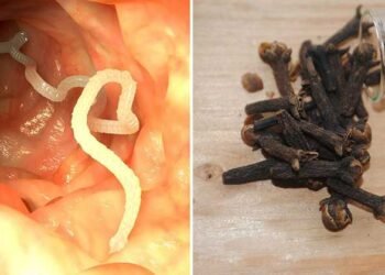 10 Warning Signs Your Body Is Full Of Parasites And 7 Foods That Can Help Kill Them