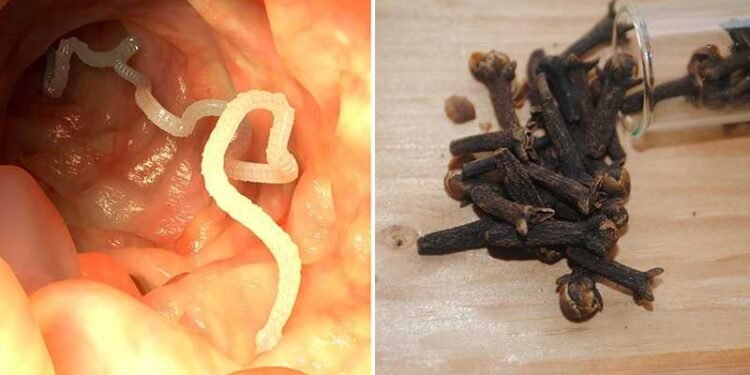 10 Warning Signs Your Body Is Full Of Parasites And 7 Foods That Can Help Kill Them
