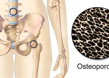 Major Study: The Drink Everyone Consumes Linked To Inflammation, Osteoporosis, and Cancer