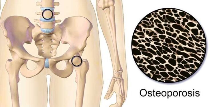 Major Study: The Drink Everyone Consumes Linked To Inflammation, Osteoporosis, and Cancer