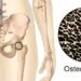 Major Study: The Drink Everyone Consumes Linked To Inflammation, Osteoporosis, and Cancer