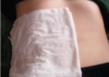 Castor Oil Packs For Liver Detox