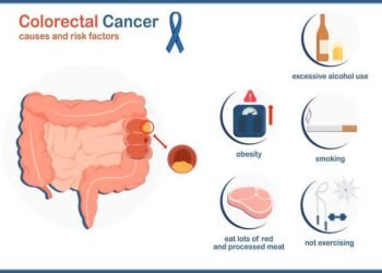 Experts warn about the rising rates of colon cancer in young people