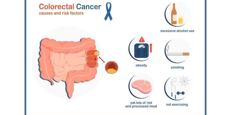 Experts warn about the rising rates of colon cancer in young people