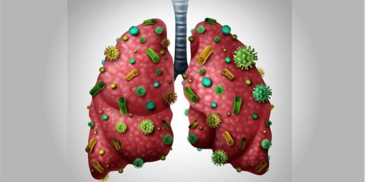 Detoxify Your Lungs With These 8 Natural Strategies That Work