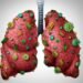 Detoxify Your Lungs With These 8 Natural Strategies That Work
