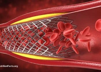 The Truth About Heart Stents