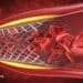 The Truth About Heart Stents