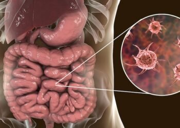 Parasite Cleanse – How To Completely Kill 100+ Types of Parasite