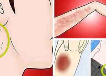 Critical Signs of Cancer You Shouldn’t Ignore