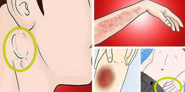 Critical Signs of Cancer You Shouldn’t Ignore