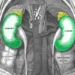 Top 10 Deadly Habits Seriously Damaging Your Kidneys