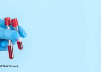 How to Treat High Lp(a), an Atherosclerosis Risk Factor 
