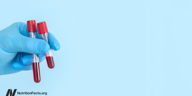 How to Treat High Lp(a), an Atherosclerosis Risk Factor 