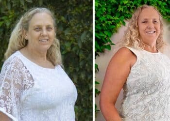 On a Plant-Based Diet, My Rheumatoid Arthritis Pain Has Disappeared