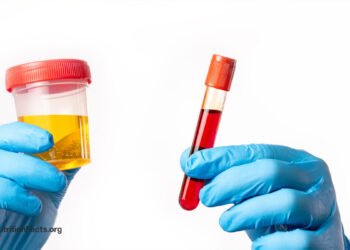 Testing for Vitamin B12 Deficiency 