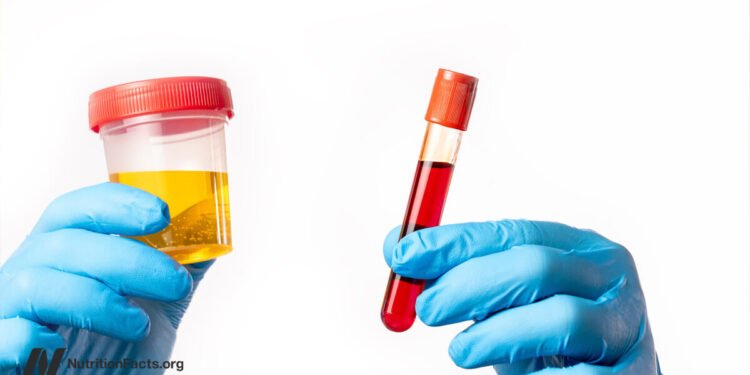 Testing for Vitamin B12 Deficiency 