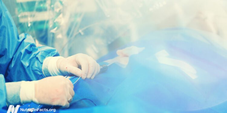 The Effectiveness of Angioplasty and Heart Stent Procedures 
