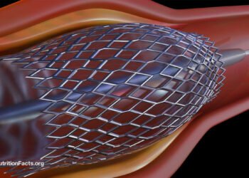 Heart Stents and Their Risks 