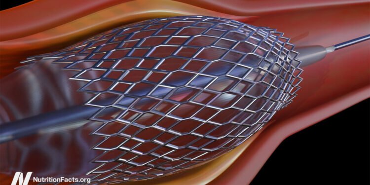 Heart Stents and Their Risks 