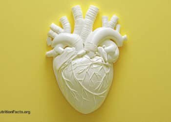 The Risks vs. Benefits of Angioplasty and Heart Stents 