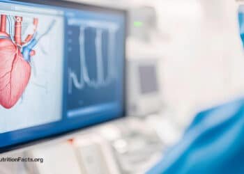 Cardiologists, Heart Stents, and Upcoding 
