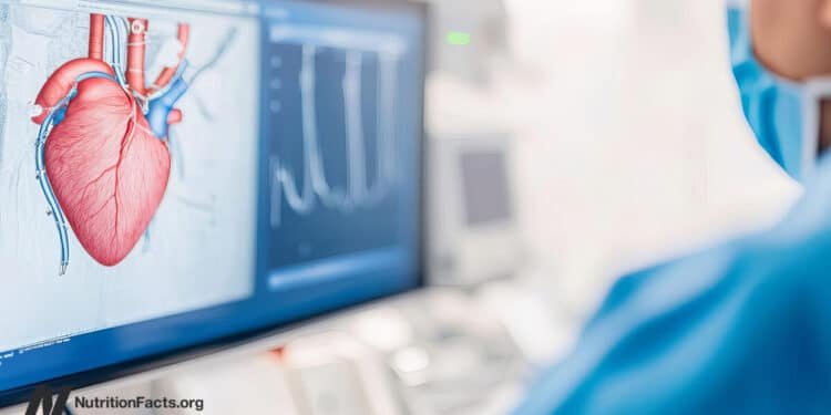 Cardiologists, Heart Stents, and Upcoding 