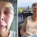 How a WFPB Diet Helped Me Overcome 20 Years of Angioedema