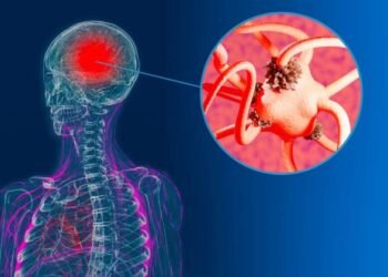 Study Claims Use Of Marijuana Could Lead To Potential Dementia Diagnosis Within The Next 5 Years