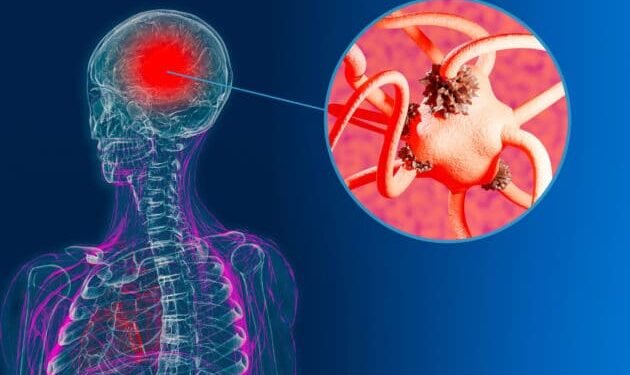 Study Claims Use Of Marijuana Could Lead To Potential Dementia Diagnosis Within The Next 5 Years