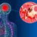 Study Claims Use Of Marijuana Could Lead To Potential Dementia Diagnosis Within The Next 5 Years