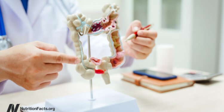 The Validity of SIBO Tests 