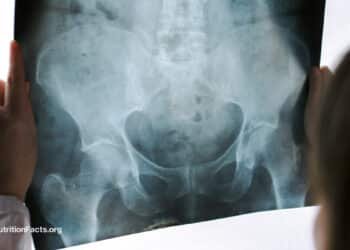 Pelvic Exams by Med Students on Anesthetized Women 
