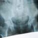 Pelvic Exams by Med Students on Anesthetized Women 
