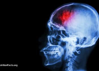 Fasting and Plant-Based Diets for Migraines and Traumatic Brain Injuries 