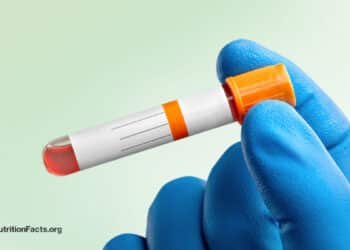 Ideal vs. Normal Cholesterol Levels 