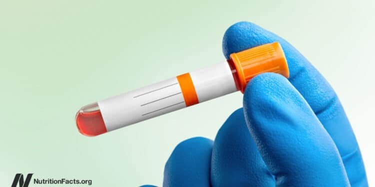 Ideal vs. Normal Cholesterol Levels 