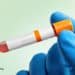 Ideal vs. Normal Cholesterol Levels 
