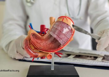 The Hidden Costs of Bariatric Surgery