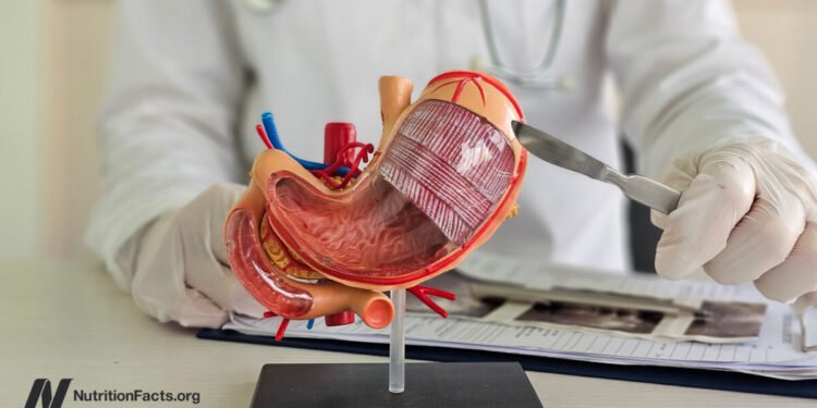 The Hidden Costs of Bariatric Surgery